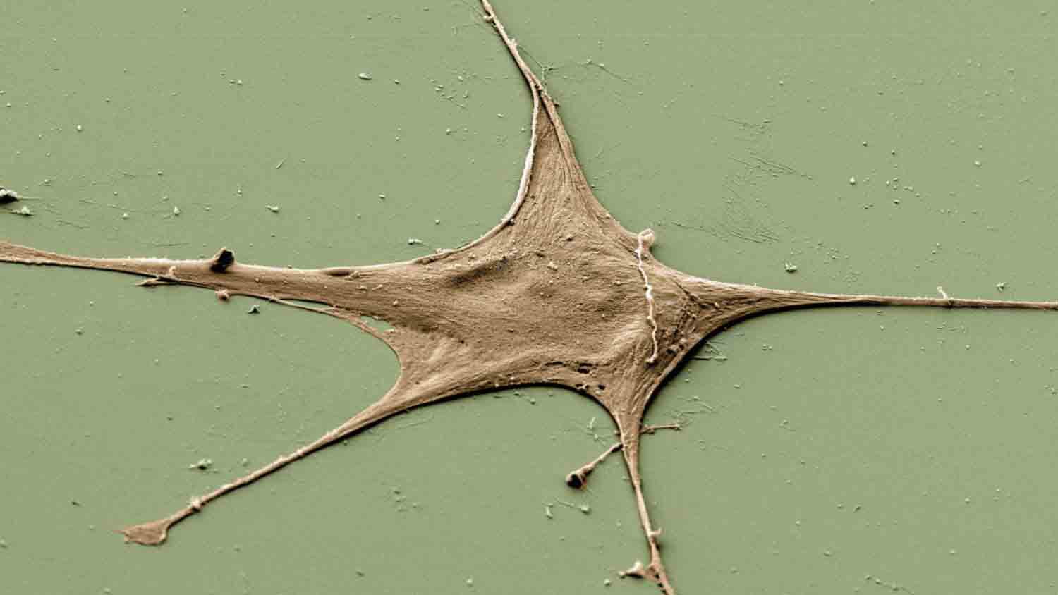 Morphogenetic and Cell Movement